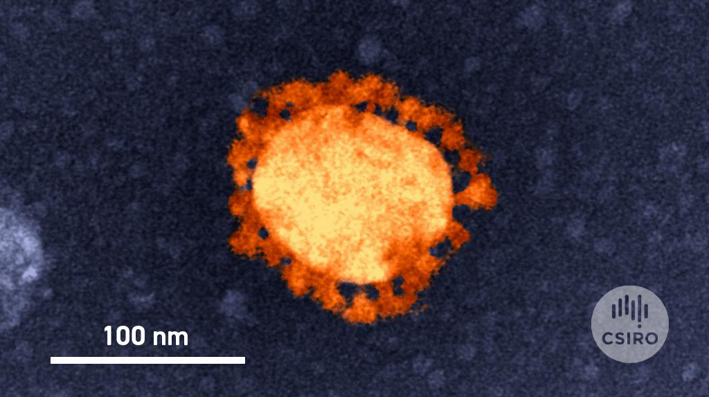 SARS-Cov-2 virus